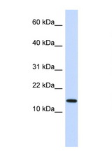 NME1 antibody LS-B4689 Western blot of Fetal Heart lysate. Antibody concentration 1 ug/ml.