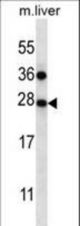 TM4SF1 Antibody western blot of mouse liver tissue lysates (35 ug/lane). The TM4SF1 antibody detected the TM4SF1 protein (arrow).