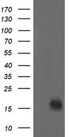 HEK293T cells were transfected with the pCMV6-ENTRY control (Left lane) or pCMV6-ENTRY NME2 (Right lane) cDNA for 48 hrs and lysed. Equivalent amounts of cell lysates (5 ug per lane) were separated by SDS-PAGE and immunoblotted with anti-NME2.