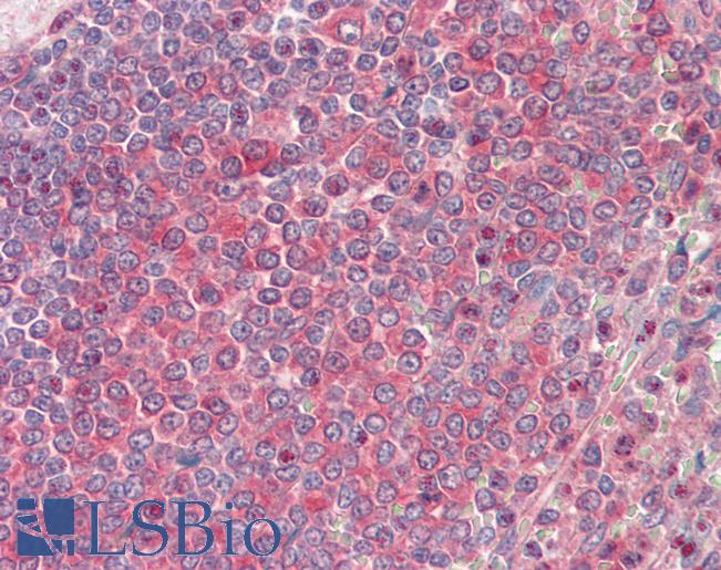 Anti-NME2 / NM23 antibody IHC staining of human spleen. Immunohistochemistry of formalin-fixed, paraffin-embedded tissue after heat-induced antigen retrieval. Antibody LS-B9880 concentration 10 ug/ml.