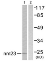 Western blot of extracts from K562 cells, using NM23 Antibody. The lane on the right is treated with the synthesized peptide.