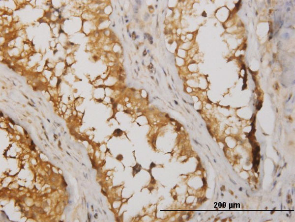 Immunoperoxidase of monoclonal antibody to NME2 on formalin-fixed paraffin-embedded human testis. [antibody concentration 1.5 ug/ml]