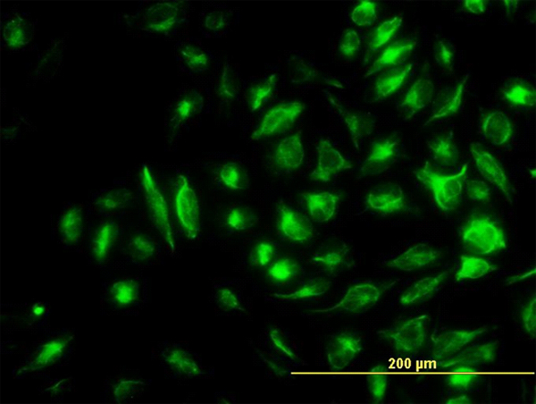 Immunofluorescence of monoclonal antibody to NME2 on HeLa cell. [antibody concentration 10 ug/ml]