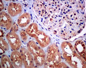 IHC of paraffin-embedded human kidney tissue using anti-NME2 antibody.