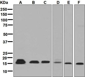 Western blot analysis on (A) LnCaP, (B) PC-12, (C) CHO, (D) 293T, (E) human spleen, and (F) human thyroid lysates using anti-NME2 antibody.