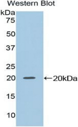 Western blot of recombinant NME2 / NM23.
