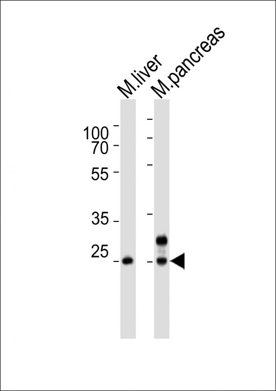 Western blot of lysates from mouse liver, mouse pancreas tissue lysate (from left to right), using Noto antibody diluted at 1:4000 at each lane. A goat anti-rabbit IgG H&L (HRP) at 1:10000 dilution was used as the secondary antibody. Lysates at 20 ug per lane.