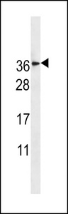 TM4SF1 Antibody western blot of HL-60 cell line lysates (35 ug/lane). The TM4SF1 antibody detected the TM4SF1 protein (arrow).
