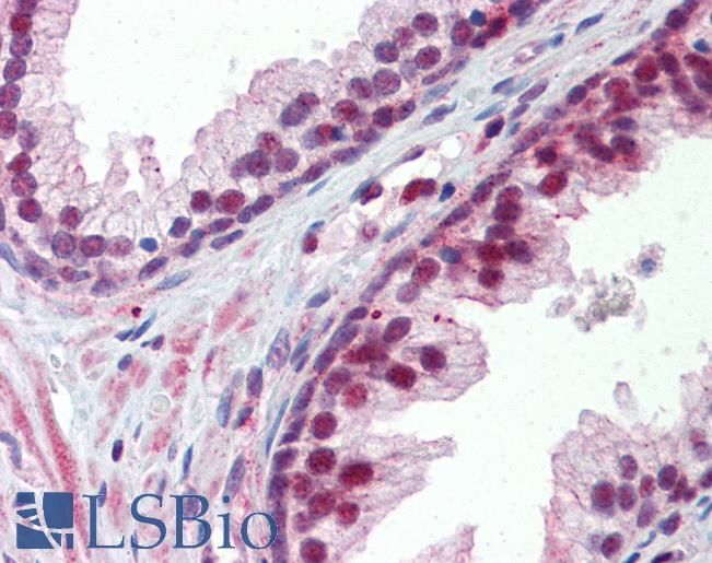 Anti-NR0B2 antibody IHC of human prostate. Immunohistochemistry of formalin-fixed, paraffin-embedded tissue after heat-induced antigen retrieval. Antibody LS-B3560 concentration 5 ug/ml.