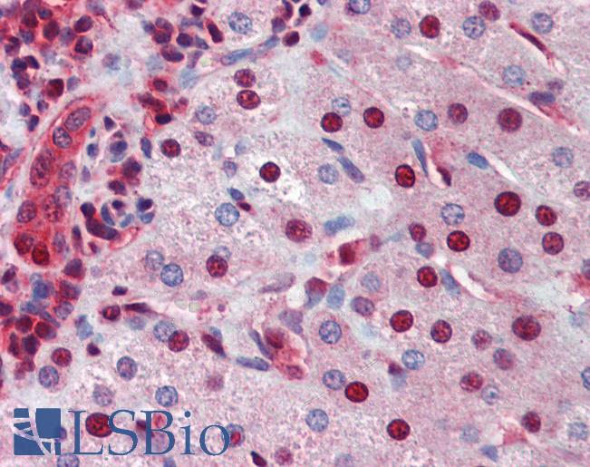 Anti-NR0B2 antibody IHC of human liver. Immunohistochemistry of formalin-fixed, paraffin-embedded tissue after heat-induced antigen retrieval. Antibody LS-B3560 concentration 5 ug/ml.