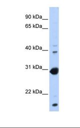 Transfected 293T cell lysate. Antibody concentration: 1.0 ug/ml. Gel concentration: 12%.