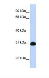 Transfected 293T cell lysate. Antibody concentration: 1.0 ug/ml. Gel concentration: 12%.