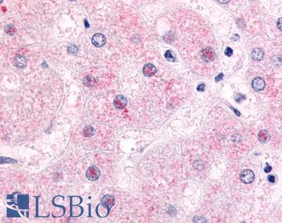 Anti-NR0B2 antibody LS-A5411 IHC of human liver, hepatocytes. Immunohistochemistry of formalin-fixed, paraffin-embedded tissue after heat-induced antigen retrieval.