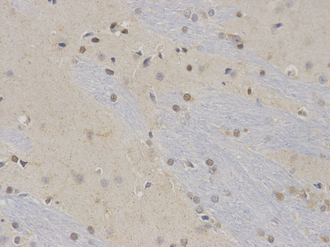 Immunohistochemistry of paraffin-embedded rat brain using NR0B2 antibody at dilution of 1:100 (400x lens).