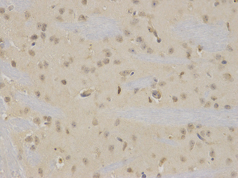 Immunohistochemistry of paraffin-embedded mouse brain using NR0B2 antibody at dilution of 1:100 (400x lens).