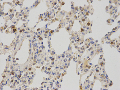 Immunohistochemistry of paraffin-embedded rat lung using NR0B2 antibody at dilution of 1:100 (400x lens).