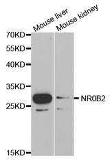 Western blot analysis of extracts of various cell lines, using NR0B2 antibody.
