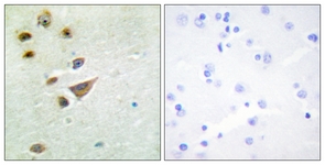 IHC of paraffin-embedded human brain tissue, using NT5C3 Antibody. The picture on the right is treated with the synthesized peptide.