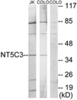 Western blot of extracts from Jurkat/COLO205 cells, using NT5C3 Antibody. The lane on the right is treated with the synthesized peptide.