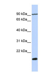 TM4SF4 antibody LS-C102233 Western blot of Jurkat lysate.