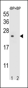 Western blot of T4S4 Antibody antibody pre-incubated without(lane 1) and with(lane 2) blocking peptide in liver cell line lysate. T4S4 Antibody (arrow) was detected using the purified Pab