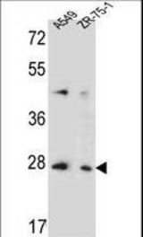 T4S4 Antibody western blot of A549,ZR-75-1 cell line lysates (35 ug/lane). The T4S4 antibody detected the T4S4 protein (arrow).