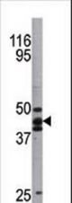Western blot of anti-hp53 antibody in A2058 cell line lysate. hp53(arrow) was detected using the purified antibody.