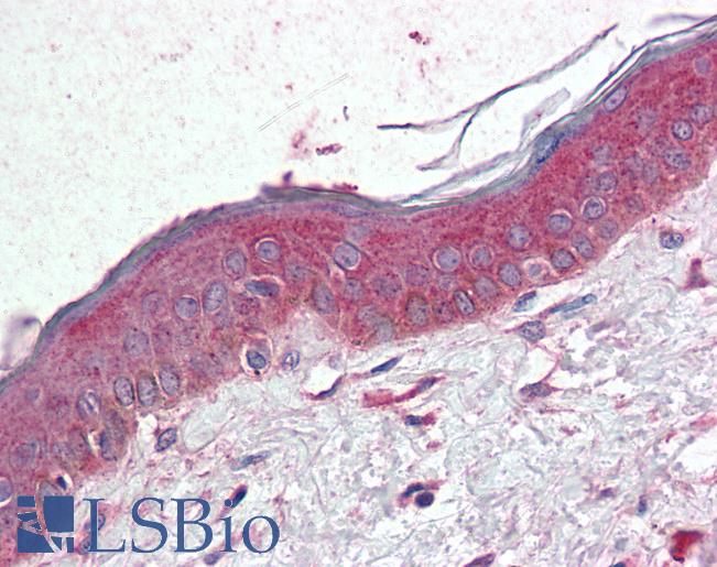 Anti-TSPAN6 antibody LS-A8762 IHC of human, skin. Immunohistochemistry of formalin-fixed, paraffin-embedded tissue after heat-induced antigen retrieval.