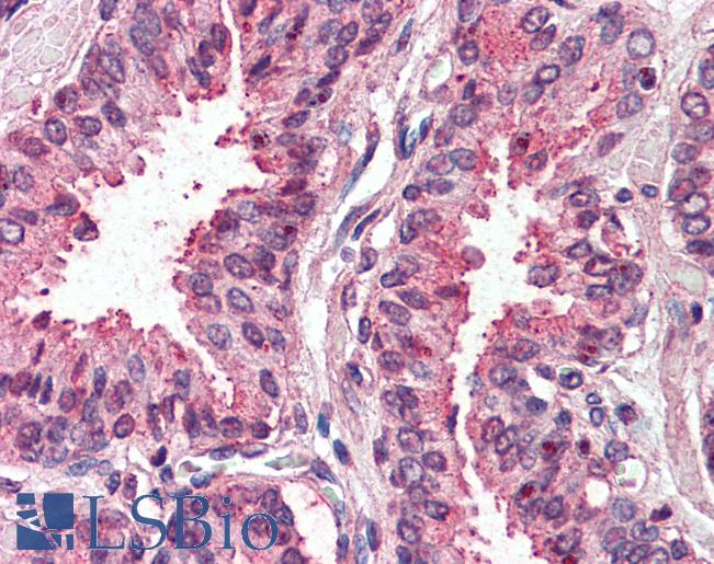 Anti-TSPAN6 antibody LS-A8762 IHC of human, prostate. Immunohistochemistry of formalin-fixed, paraffin-embedded tissue after heat-induced antigen retrieval.
