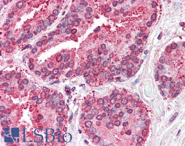 Anti-TSPAN6 antibody LS-A8760 IHC of human prostate. Immunohistochemistry of formalin-fixed, paraffin-embedded tissue after heat-induced antigen retrieval.