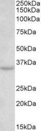 TSPAN5 antibody (0.3 ug/ml) staining of Mouse Brain lysate (35 ug protein in RIPA buffer). Primary incubation was 1 hour. Detected by chemiluminescence.