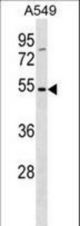 TM6SF1 Antibody western blot of A549 cell line lysates (35 ug/lane). The TM6SF1 antibody detected the TM6SF1 protein (arrow).