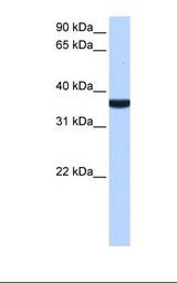 Fetal liver cell lysate. Antibody concentration: 0.5 ug/ml. Gel concentration: 12%.