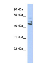 TP53I13 antibody LS-C102394 Western blot of OVCAR-3 cell lysate.