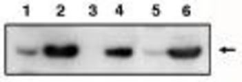 Western blot of anti-PIG3 antibody on RKO cells transfected with pCEP4 without insert (1), transfected with pCEP4-PIG3 (2), under control conditions (3) and treated with Adriamycin to activate wild-type p53 (4). Also used on MCF-7 cells transfected with pCEP4 without insert (5) and pCEP4-PIG3 (6).