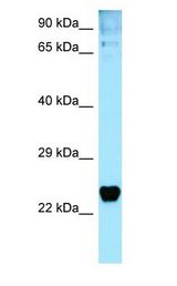 TP53I3 / PIG3 antibody Western Blot of MCF7.