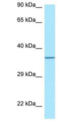 TP53I3 / PIG3 antibody Western Blot of HepG2.