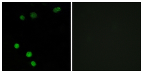 Immunofluorescence of MCF7 cells, using TP53INP2 Antibody. The picture on the right is treated with the synthesized peptide.