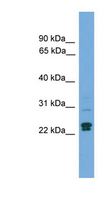 TP53INP2 antibody LS-C117094 Western blot of Fetal Heart lysate.