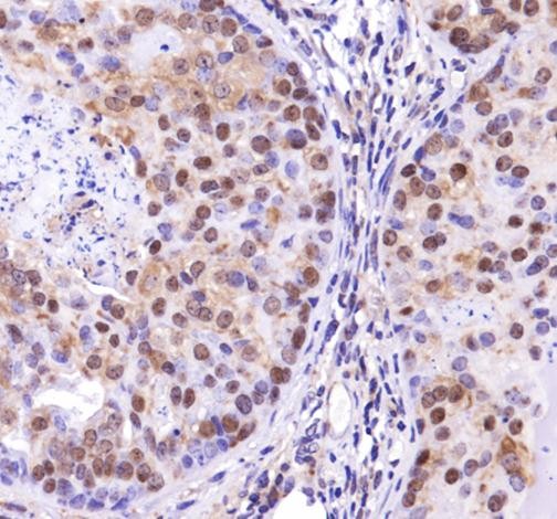 Immunohistochemistry: TP53INP2 Antibody - Staining of TP53INP2 in mouse prostate.