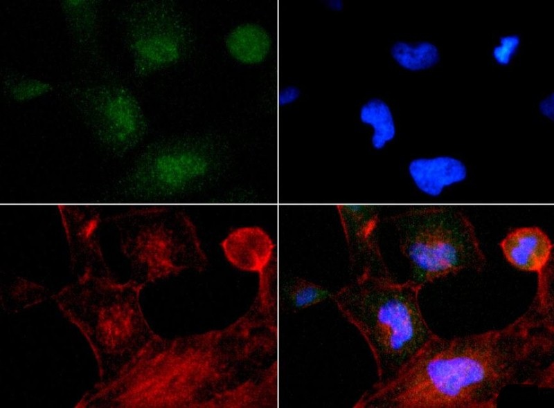 Immunocytochemistry/Immunofluorescence: TP53INP2 Antibody - TP53INP2 antibody was tested at 1:200 in HeLa cells with FITC (green). Nuclei and actin were counterstained with Dapi (blue) and Phalloidin (red).