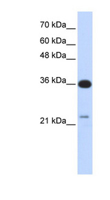 TP53TG5 / C20orf10 antibody LS-C102550 Western blot of Transfected 293T cell lysate.