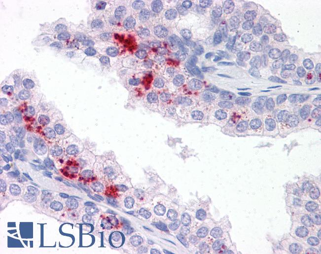 Anti-TM9SF1 antibody LS-A9222 IHC of human prostate. Immunohistochemistry of formalin-fixed, paraffin-embedded tissue after heat-induced antigen retrieval.