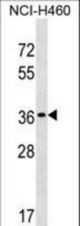 TP53TG5 Antibody western blot of NCI-H460 cell line lysates (35 ug/lane). The TP53TG5 antibody detected the TP53TG5 protein (arrow).