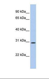 721_B cell lysate. Antibody concentration: 1.0 ug/ml. Gel concentration: 12%.