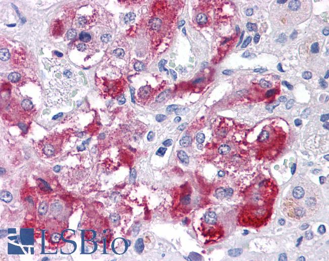 Anti-TM9SF1 antibody LS-A9222 IHC of human adrenal. Immunohistochemistry of formalin-fixed, paraffin-embedded tissue after heat-induced antigen retrieval.