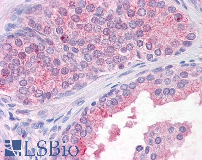 Anti-TM9SF1 antibody LS-A9224 IHC of human, prostate. Immunohistochemistry of formalin-fixed, paraffin-embedded tissue after heat-induced antigen retrieval.