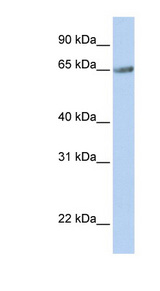 TM9SF1 antibody LS-C110974 Western blot of Fetal Muscle lysate.