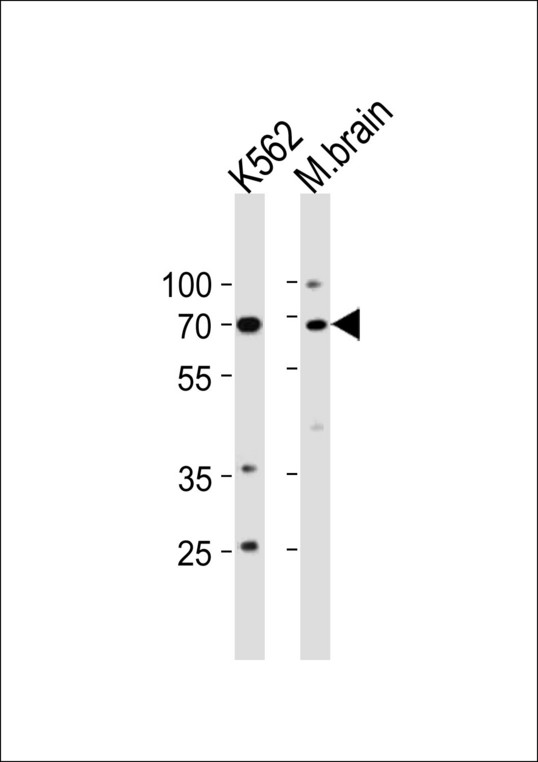 TP73 Antibody western blot of K562 cell line and mouse brain tissue lysates (35 ug/lane). The TP73 antibody detected the TP73 protein (arrow).