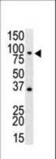 Western blot of anti-mTLR4 antibody in mouse spleen cell lysate. mTLR4 (arrow) was detected using purified antibody. Secondary HRP-anti-rabbit was used for signal visualization with chemiluminescence.